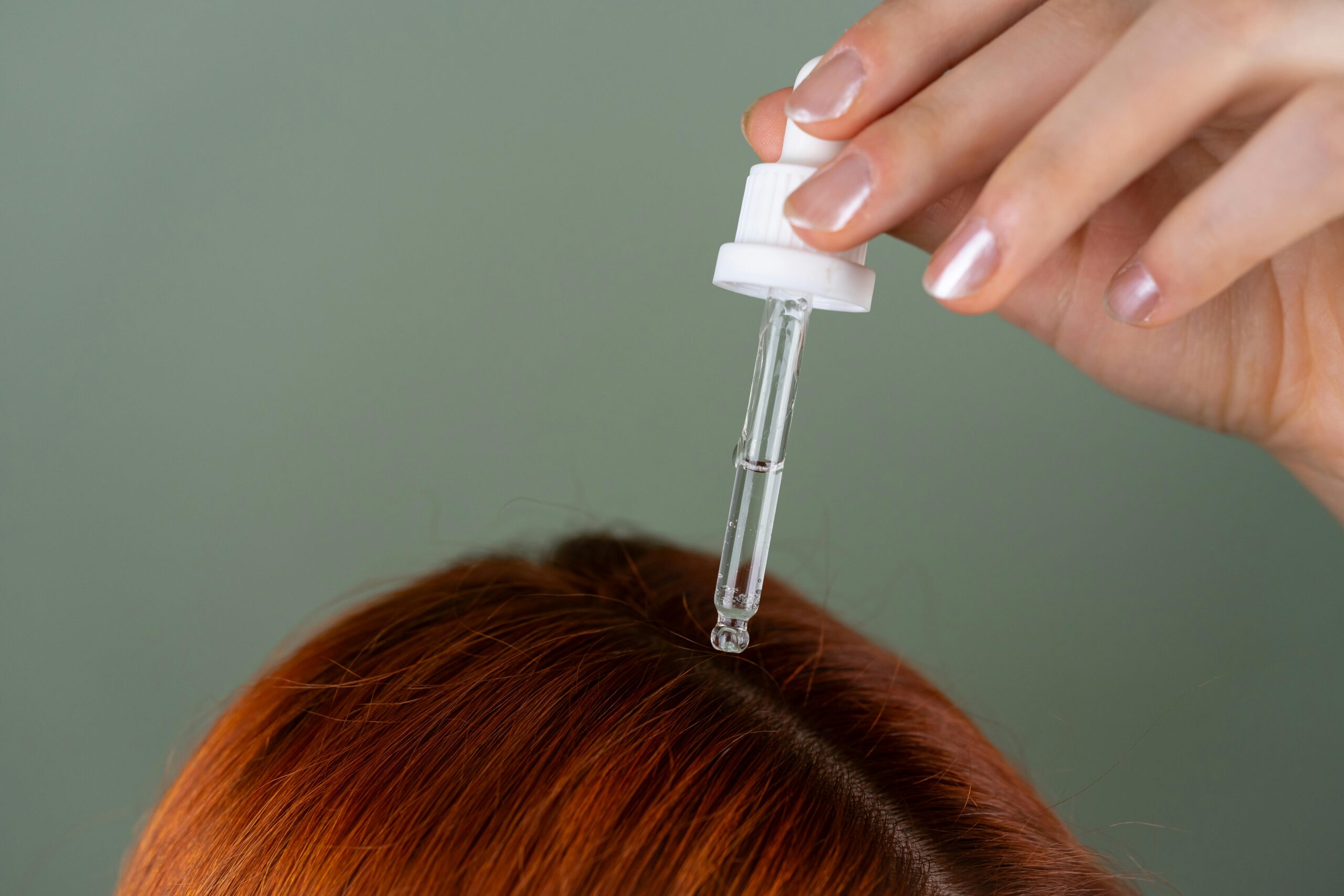 A hand applies liquid to the scalp of a person with red hair using a dropper, reflecting a personal journey through menopause and its impact on hair loss.