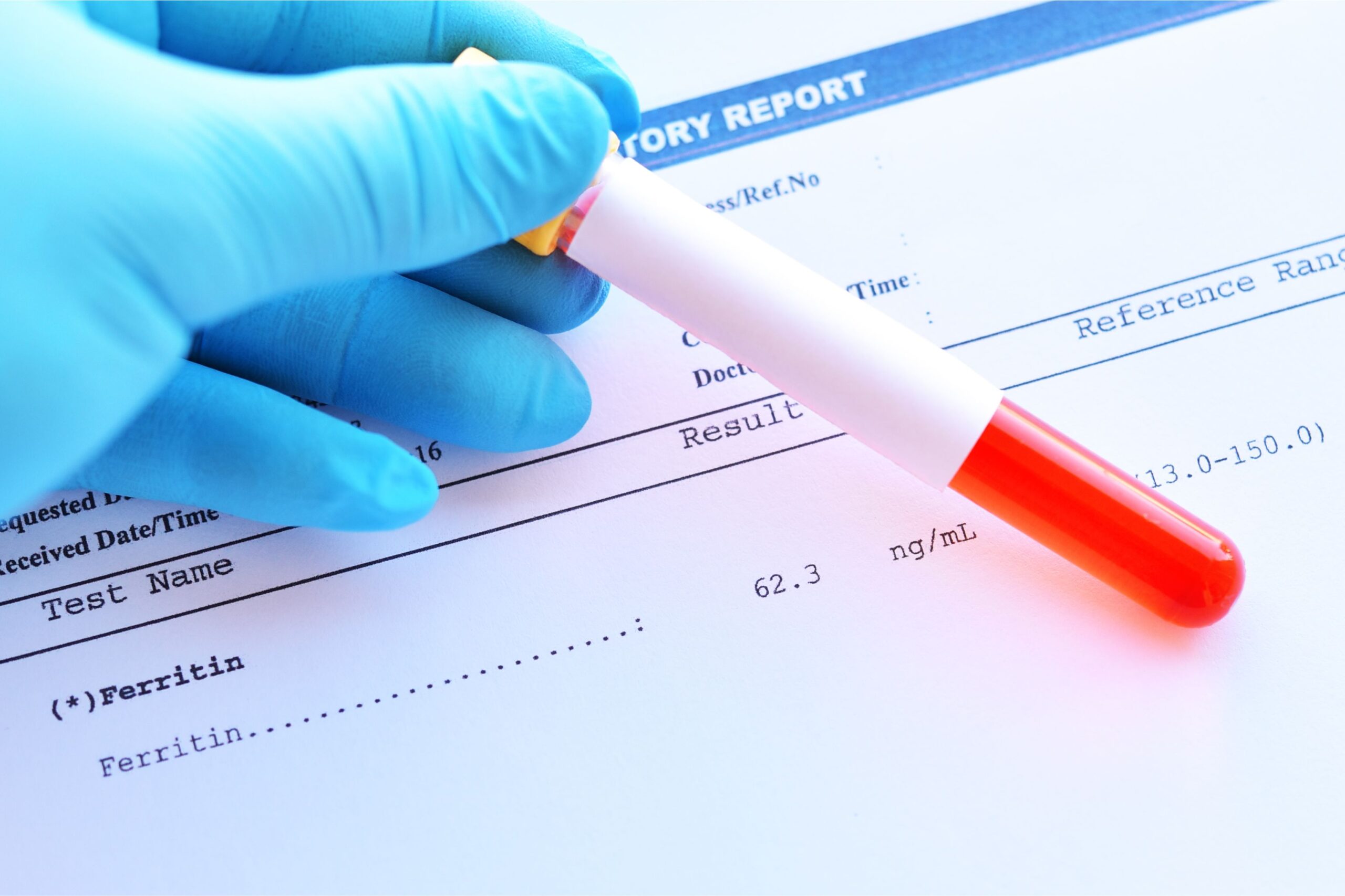 A gloved hand holds a test tube with blood above a laboratory report, offering a glimpse into ferritin explained through detailed level results.