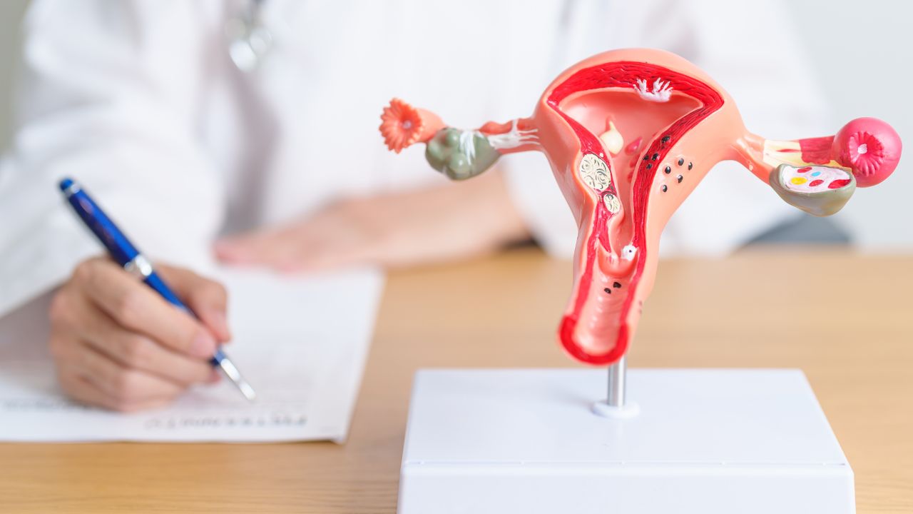 A person writes on a document next to a 3D anatomical model of a female reproductive system on the table, emphasizing that cervical health can't wait when it comes to women's health.